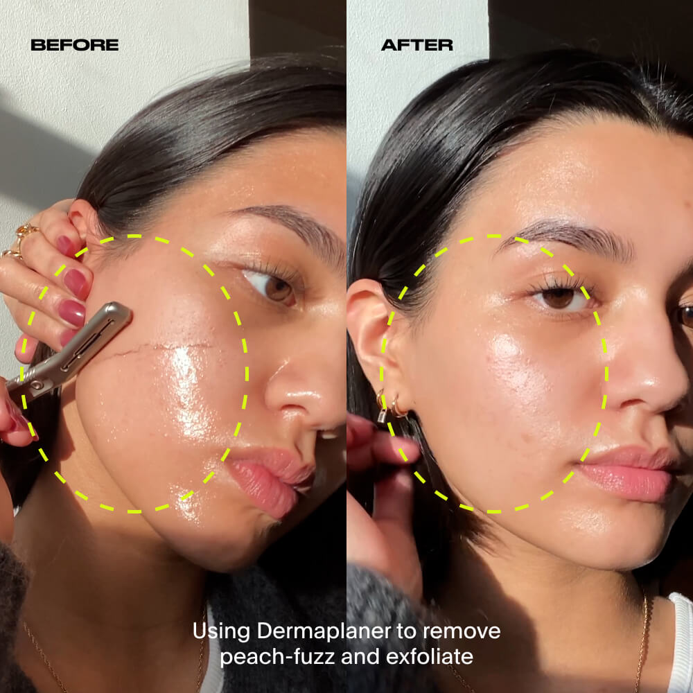 Dermaplaner, Silver